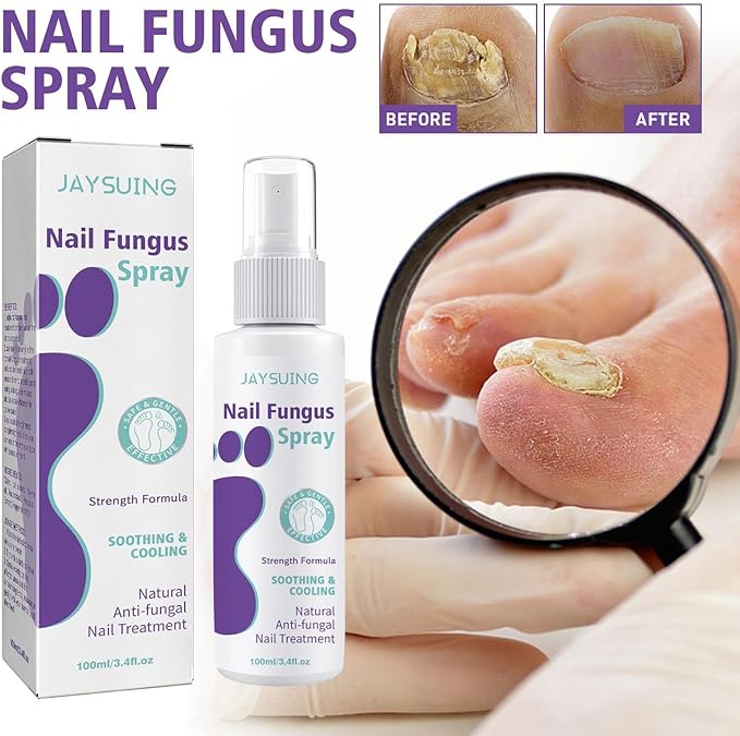 Gentle Nail Fungus Remover Maxum